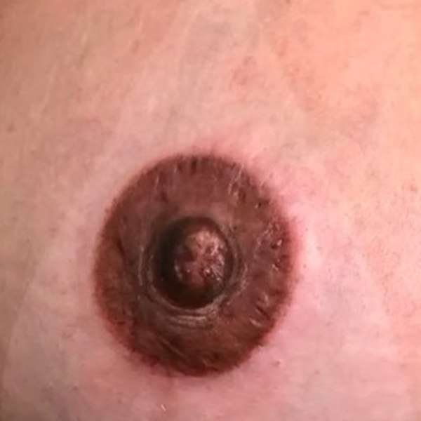 After — Case 04