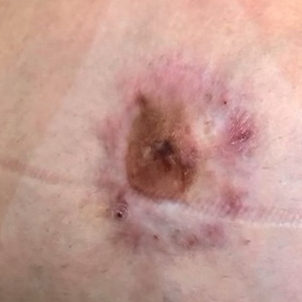 Before — Case 04