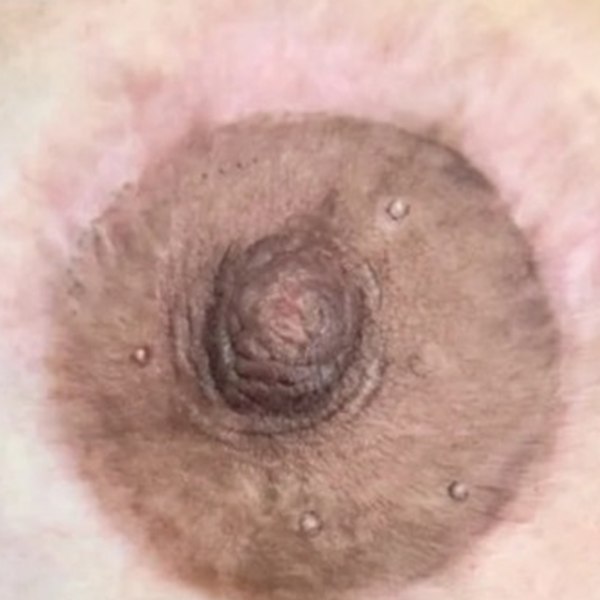 After — Case 06